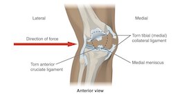 Knee diagram.